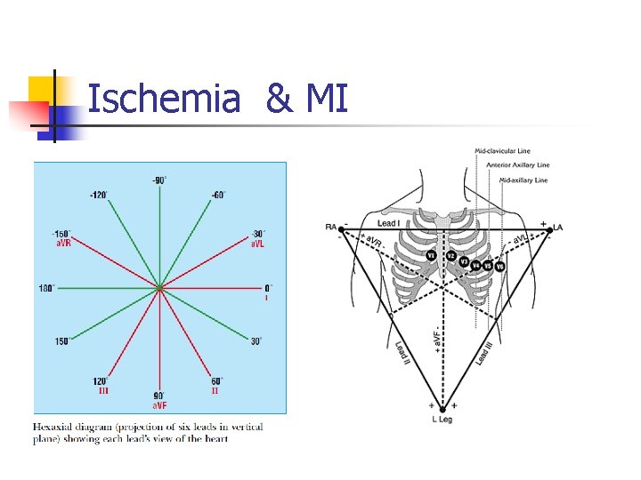 Ischemia & MI Ischemia & MI