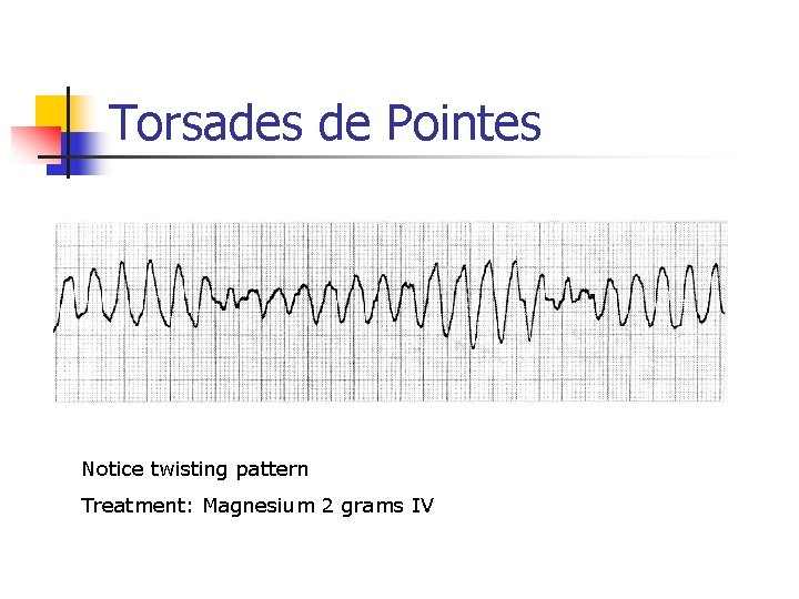 Torsades de Pointes Notice twisting pattern Treatment: Magnesium 2 grams IV Torsades de Pointes Notice twisting pattern Treatment: Magnesium 2 grams IV