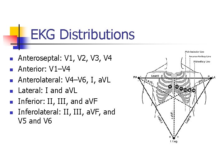 EKG Distributions n n n Anteroseptal: V 1, V 2, V 3, V 4
