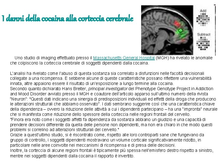 I danni della cocaina alla corteccia cerebrale Uno studio di imaging effettuato presso il