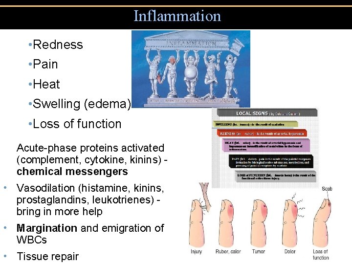 Inflammation • Redness • Pain • Heat • Swelling (edema) • Loss of function