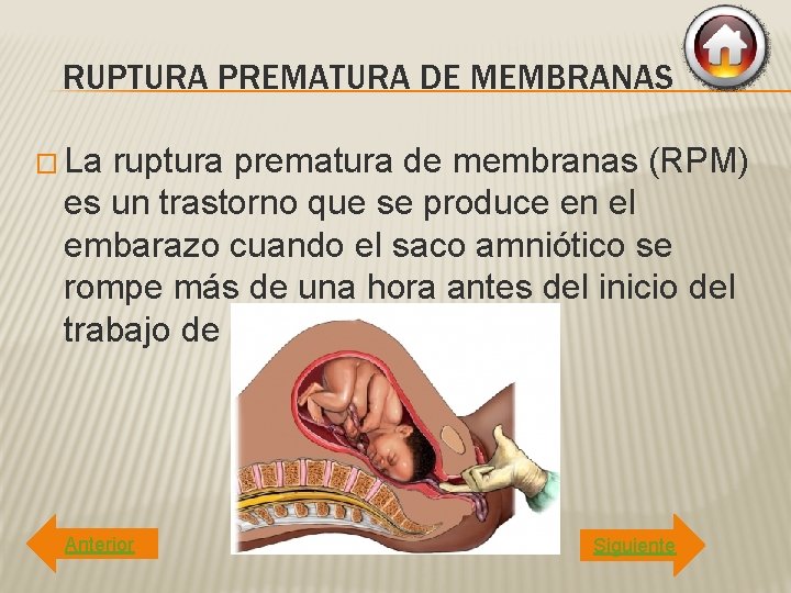 RUPTURA PREMATURA DE MEMBRANAS � La ruptura prematura de membranas (RPM) es un trastorno