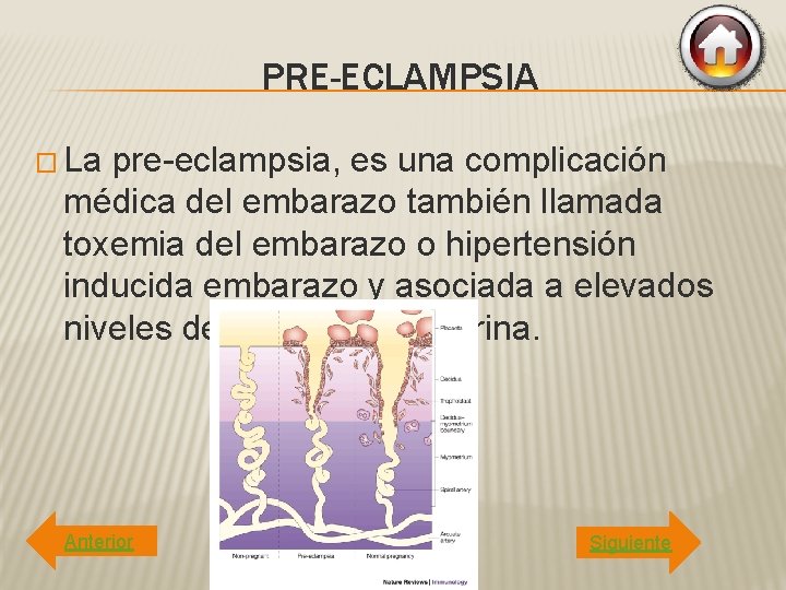 PRE-ECLAMPSIA � La pre-eclampsia, es una complicación médica del embarazo también llamada toxemia del