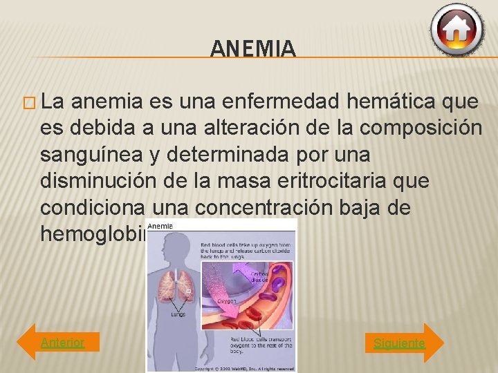 ANEMIA � La anemia es una enfermedad hemática que es debida a una alteración