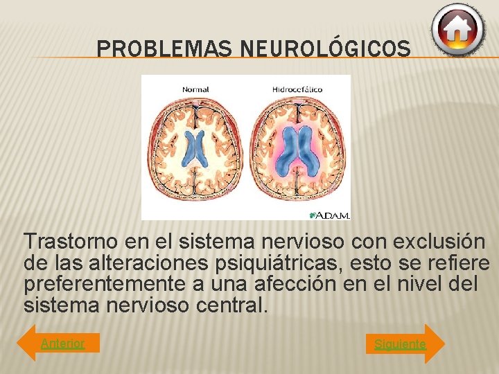 PROBLEMAS NEUROLÓGICOS Trastorno en el sistema nervioso con exclusión de las alteraciones psiquiátricas, esto