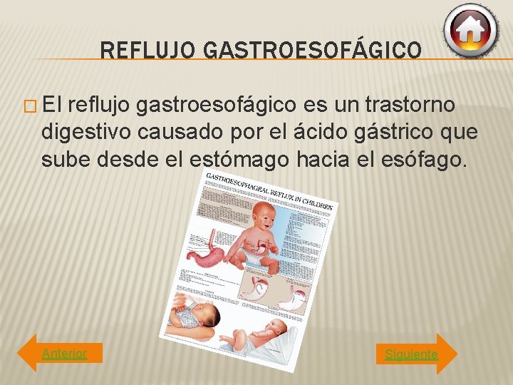 REFLUJO GASTROESOFÁGICO � El reflujo gastroesofágico es un trastorno digestivo causado por el ácido