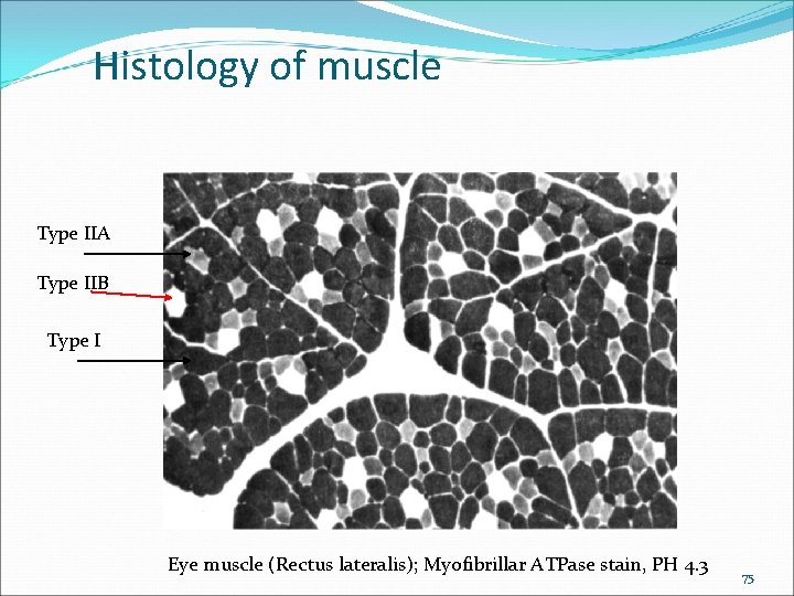 Histology of muscle Type IIA Type IIB Type I Eye muscle (Rectus lateralis); Myofibrillar