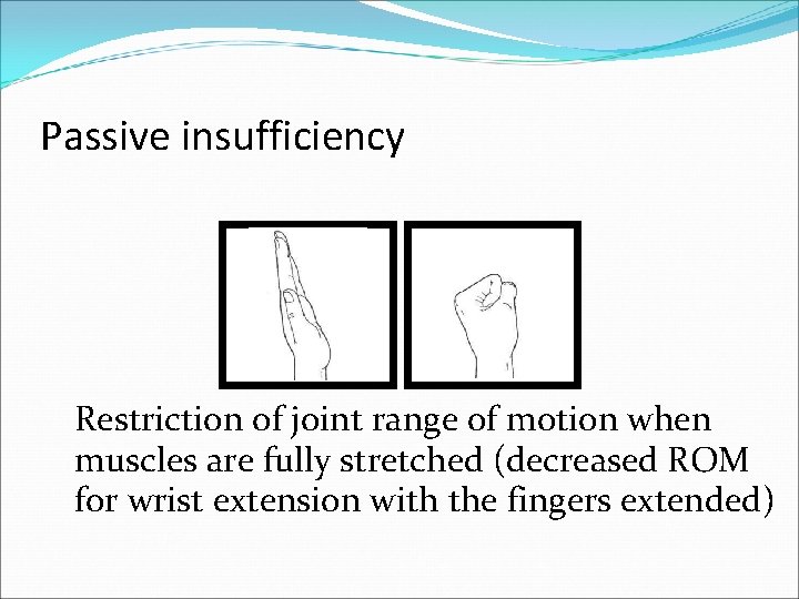 Passive insufficiency Restriction of joint range of motion when muscles are fully stretched (decreased