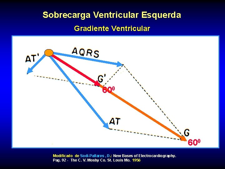 Sobrecarga Ventricular Esquerda Gradiente Ventricular 600 Modificado de Sodi-Pallares , D. : New Bases