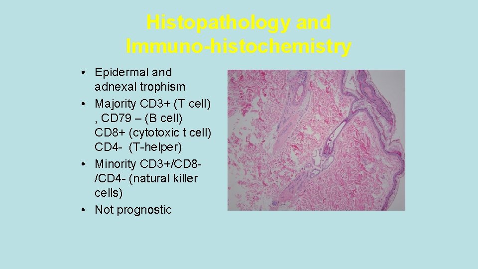 Histopathology and Immuno-histochemistry • Epidermal and adnexal trophism • Majority CD 3+ (T cell)