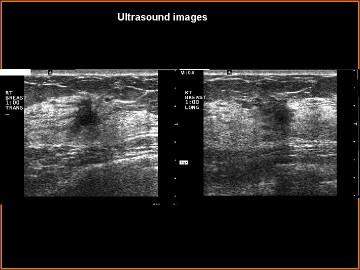 Ultrasound images 