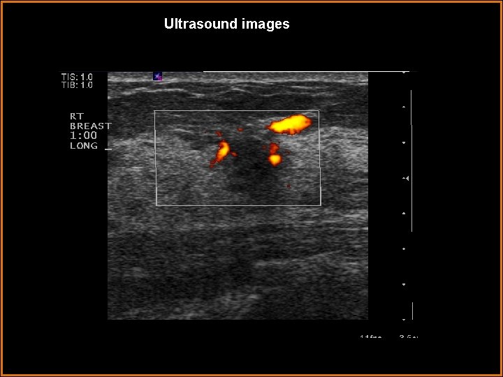 Ultrasound images 