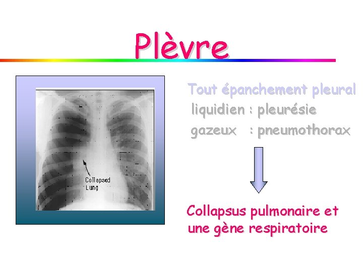 Plèvre Tout épanchement pleural liquidien : pleurésie gazeux : pneumothorax Collapsus pulmonaire et une