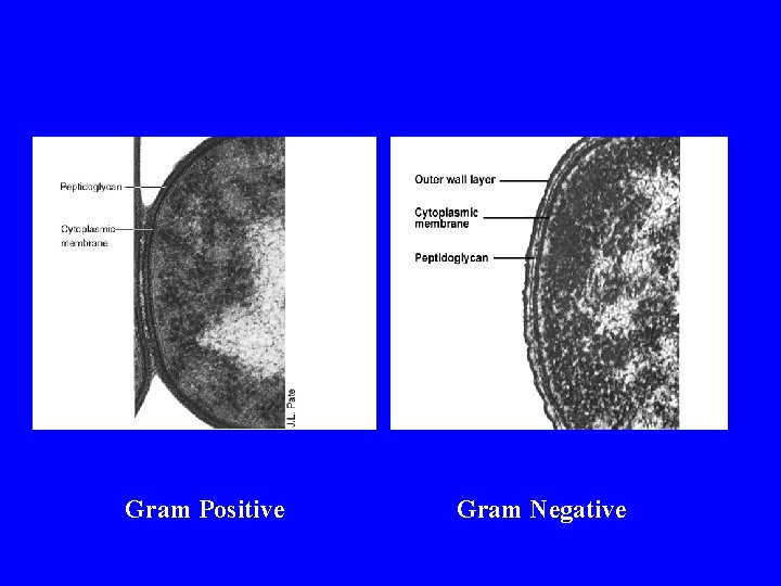 Gram Positive Gram Negative 