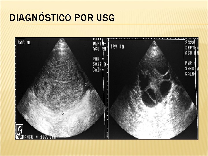 DIAGNÓSTICO POR USG 