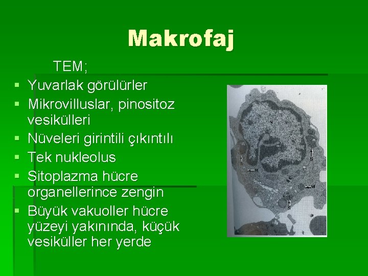 Makrofaj § § § TEM; Yuvarlak görülürler Mikrovilluslar, pinositoz vesikülleri Nüveleri girintili çıkıntılı Tek