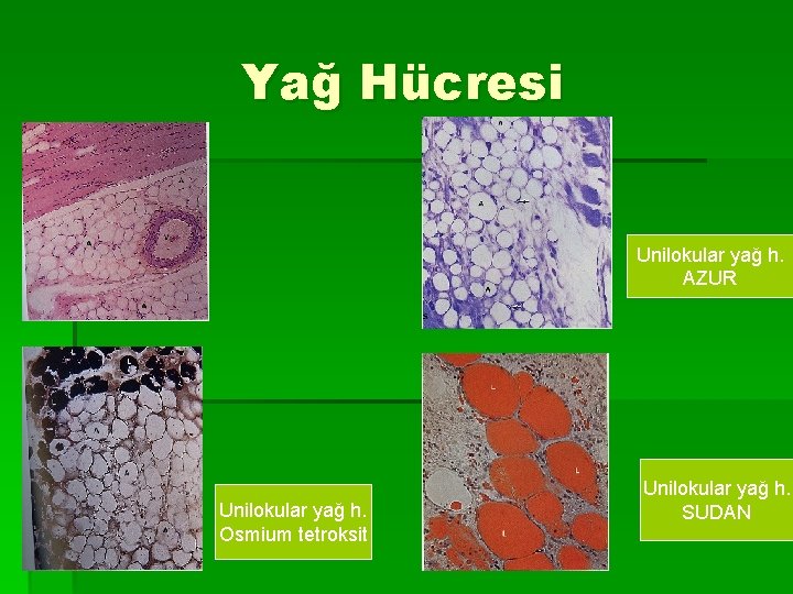 Yağ Hücresi Unilokular yağ h. AZUR Unilokular yağ h. Osmium tetroksit Unilokular yağ h.