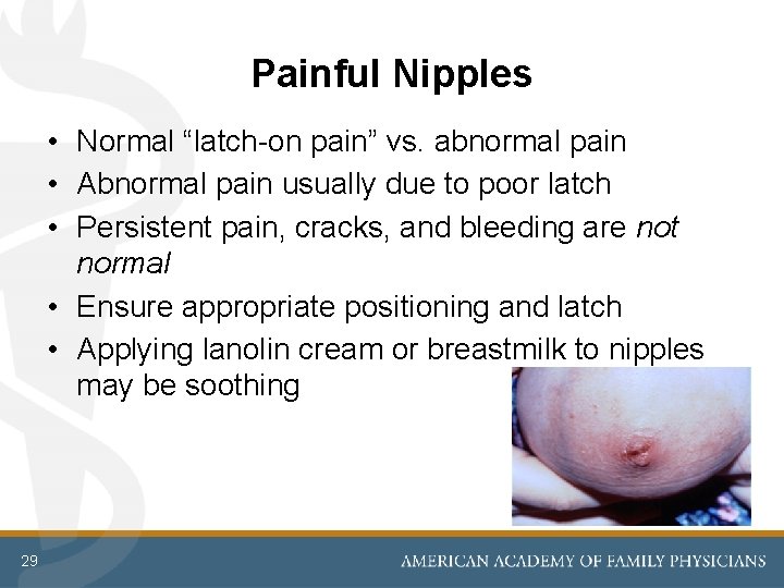 Painful Nipples • Normal “latch-on pain” vs. abnormal pain • Abnormal pain usually due