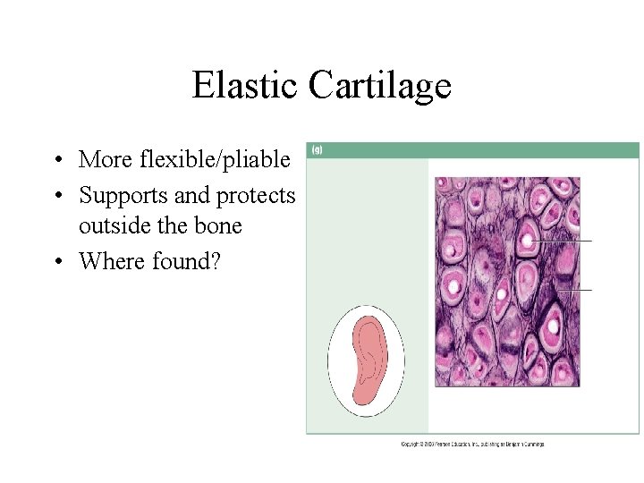 Elastic Cartilage • More flexible/pliable • Supports and protects outside the bone • Where