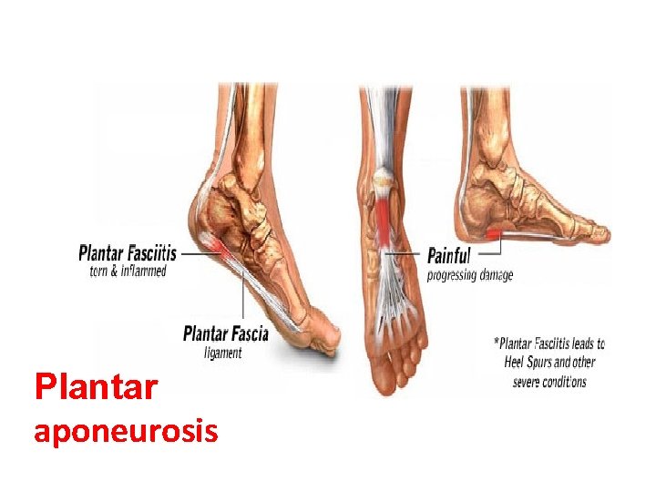 Plantar aponeurosis 