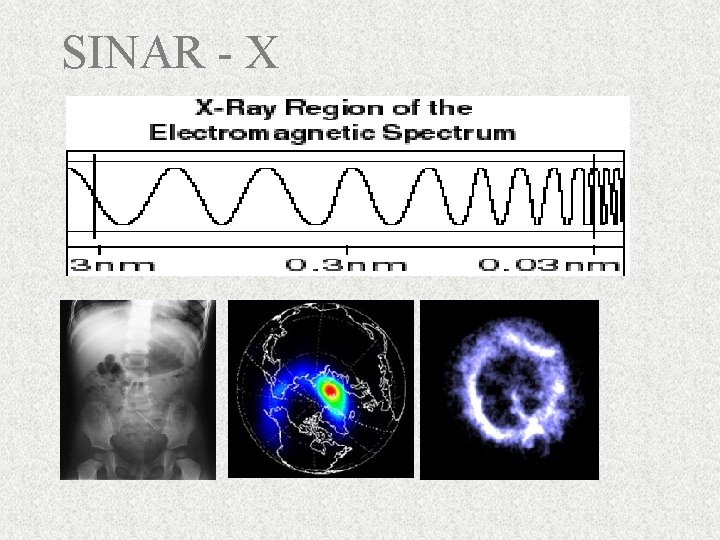 SINAR - X 