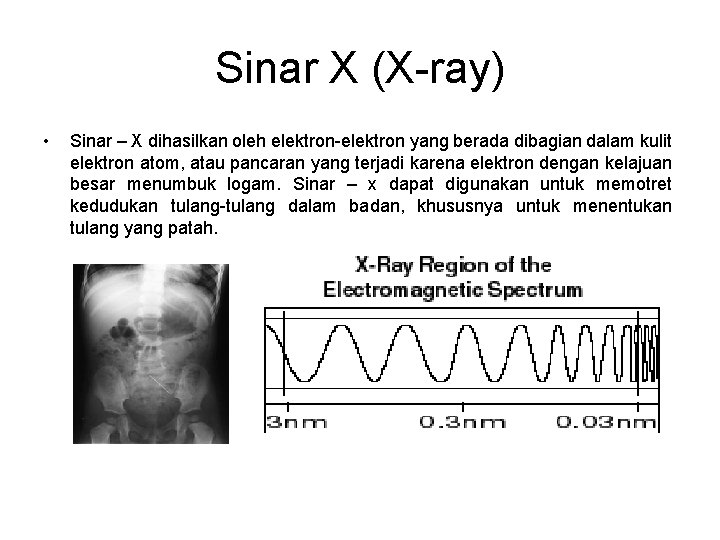 Sinar X (X-ray) • Sinar – X dihasilkan oleh elektron-elektron yang berada dibagian dalam