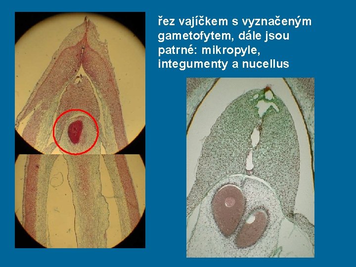 řez vajíčkem s vyznačeným gametofytem, dále jsou patrné: mikropyle, integumenty a nucellus 