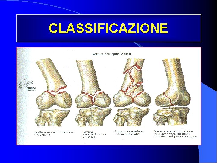 CLASSIFICAZIONE 