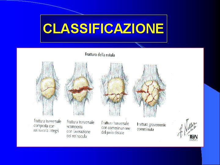 CLASSIFICAZIONE 
