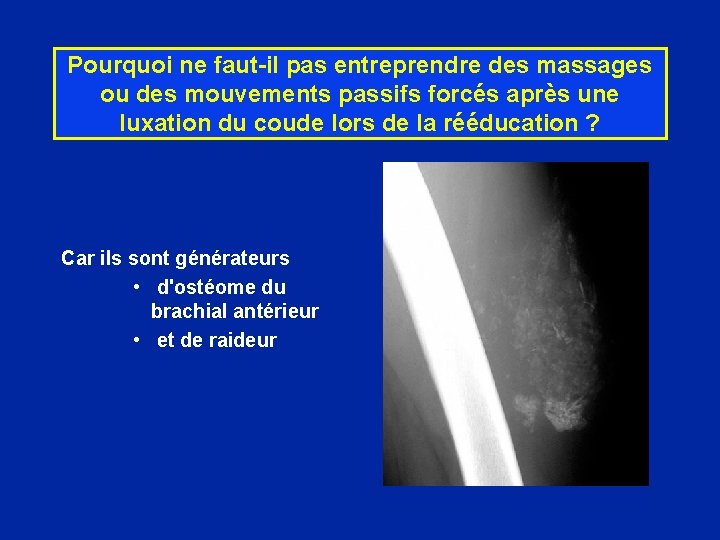 Pourquoi ne faut-il pas entreprendre des massages ou des mouvements passifs forcés après une