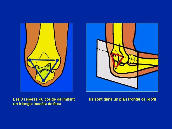 Les 3 repères du coude délimitent un triangle isocèle de face Ils sont dans