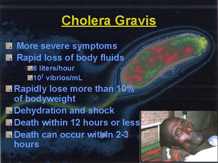 Cholera Gravis More severe symptoms Rapid loss of body fluids 6 liters/hour 107 vibrios/m.