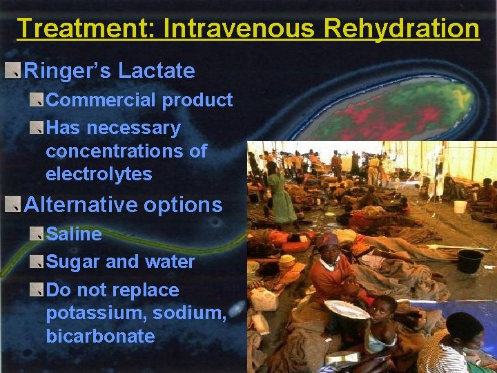 Treatment: Intravenous Rehydration Ringer’s Lactate Commercial product Has necessary concentrations of electrolytes Alternative options