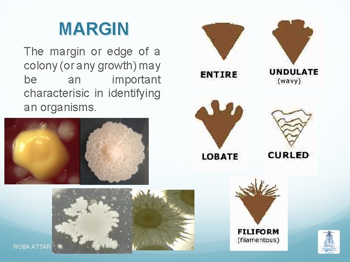 MARGIN The margin or edge of a colony (or any growth) may be an MARGIN The margin or edge of a colony (or any growth) may be an