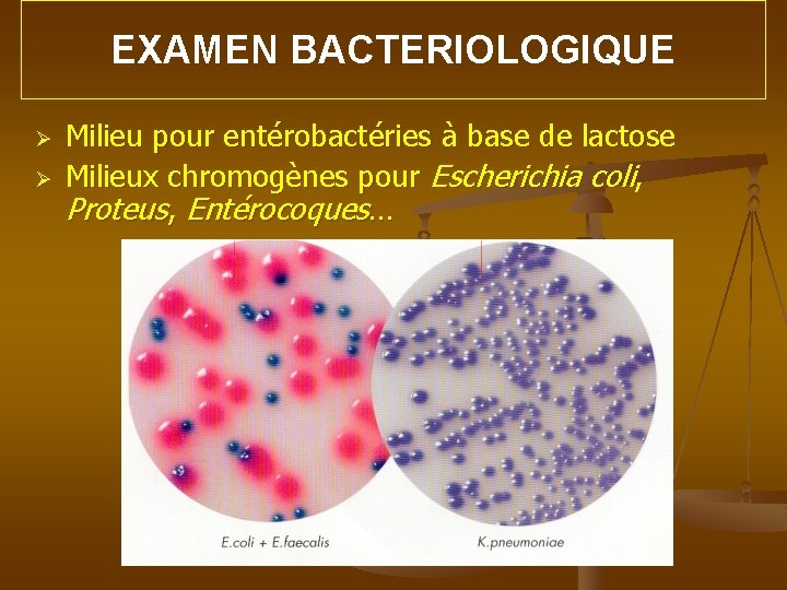 EXAMEN BACTERIOLOGIQUE Ø Ø Milieu pour entérobactéries à base de lactose Milieux chromogènes pour