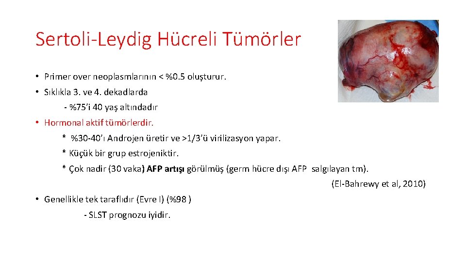 Sertoli-Leydig Hücreli Tümörler • Primer over neoplasmlarının < %0. 5 oluşturur. • Sıklıkla 3.