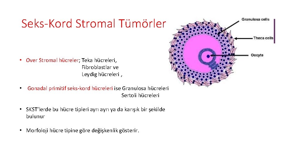 Seks-Kord Stromal Tümörler • Over Stromal hücreler; Teka hücreleri, Fibroblastlar ve Leydig hücreleri ,