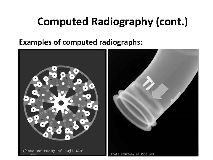 Computed Radiography (cont. ) Examples of computed radiographs: 