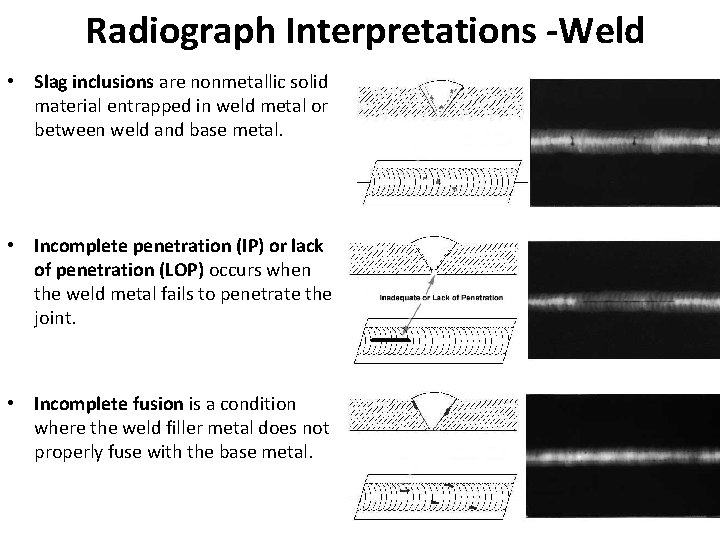 Radiograph Interpretations -Weld • Slag inclusions are nonmetallic solid material entrapped in weld metal