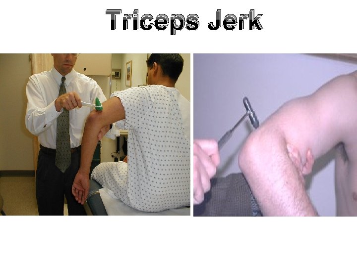 Triceps Jerk Triceps Jerk