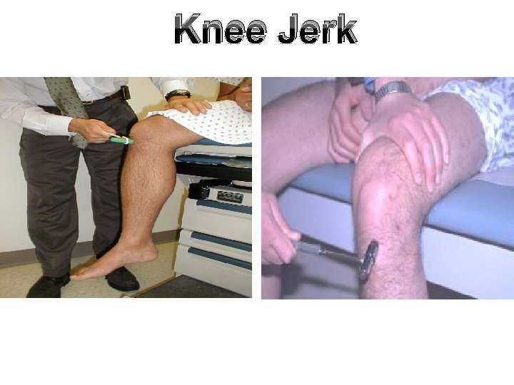 Knee Jerk Knee Jerk