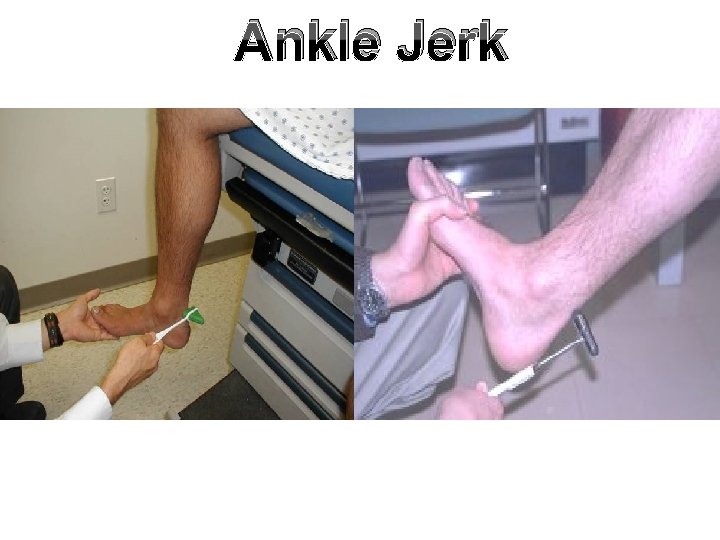 Ankle Jerk Ankle Jerk