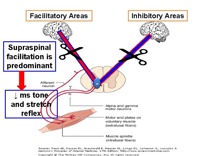 Facilitatory Areas Inhibitory Areas Supraspinal facilitation is predominant +- ↓ ms tone and stretch