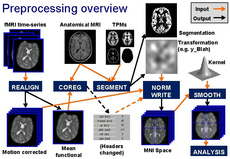 Preprocessing overview Input Output f. MRI time-series Anatomical MRI TPMs Segmentation Transformation (e. g.