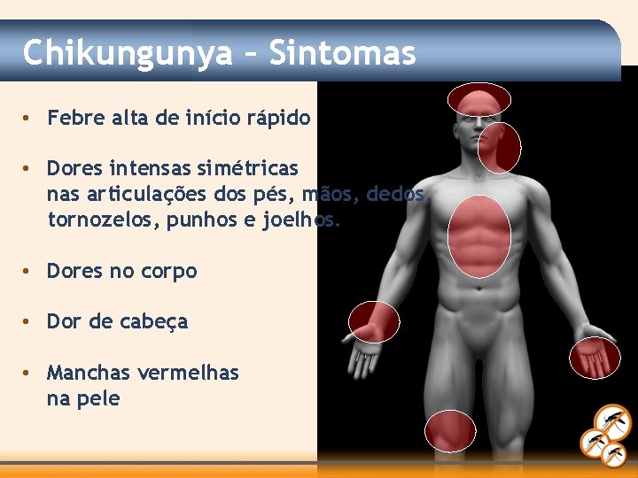 Chikungunya – Sintomas • Febre alta de início rápido • Dores intensas simétricas nas