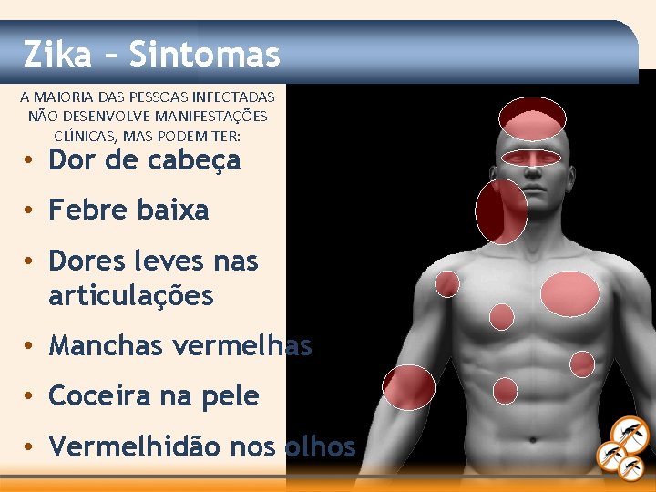 Zika – Sintomas A MAIORIA DAS PESSOAS INFECTADAS NÃO DESENVOLVE MANIFESTAÇÕES CLÍNICAS, MAS PODEM