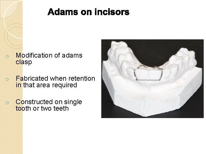 o Modification of adams clasp o Fabricated when retention in that area required o o Modification of adams clasp o Fabricated when retention in that area required o