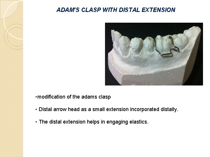 ADAM’S CLASP WITH DISTAL EXTENSION • modification of the adams clasp • Distal arrow