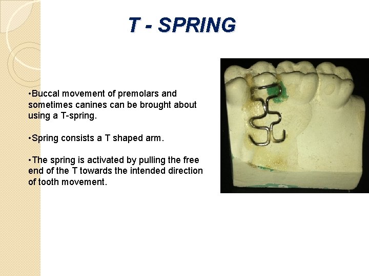 T - SPRING • Buccal movement of premolars and sometimes canines can be brought