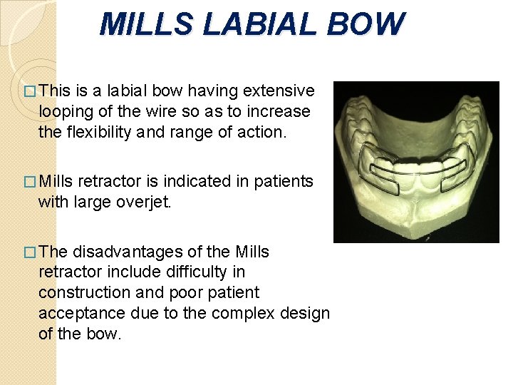MILLS LABIAL BOW � This is a labial bow having extensive looping of the